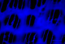 Asian carp gill raker (photo by UMESC)